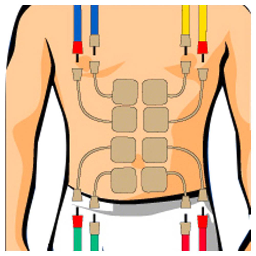 Sport Tec Compex Elektroden Wire, 5x5 cm, 4 Stück Lagerräumung