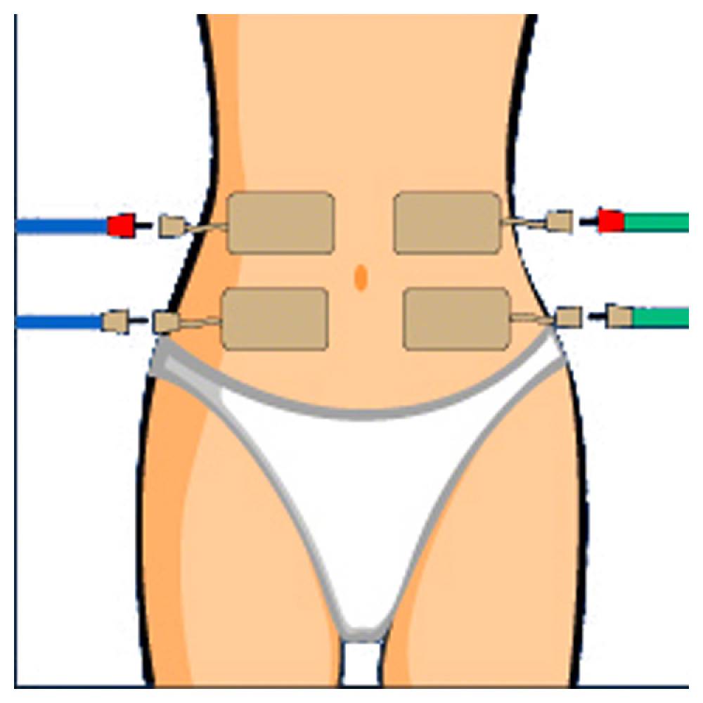 Sport Tec Compex Elektroden Wire, 5x10 cm, 2 Stück Heißer Verkauf