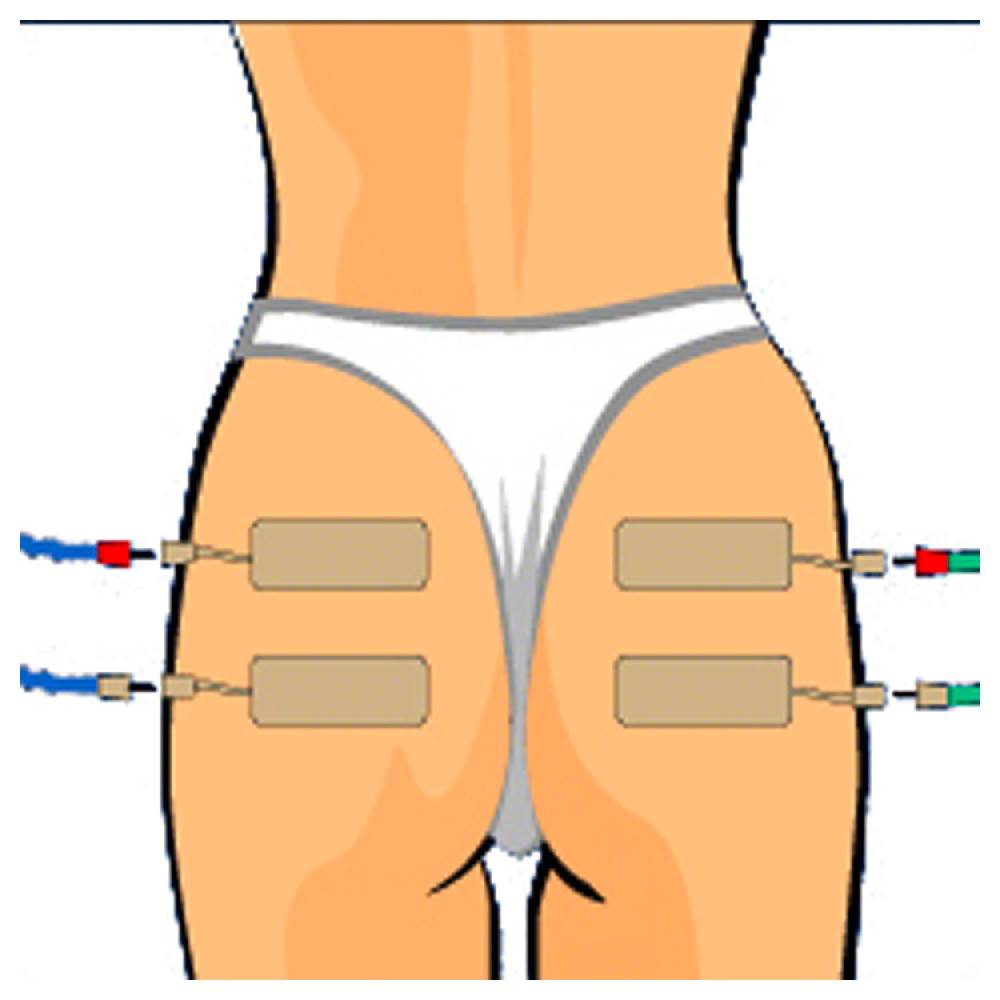 Sport Tec Compex Elektroden Wire, 5x10 cm, 2 Stück Heißer Verkauf