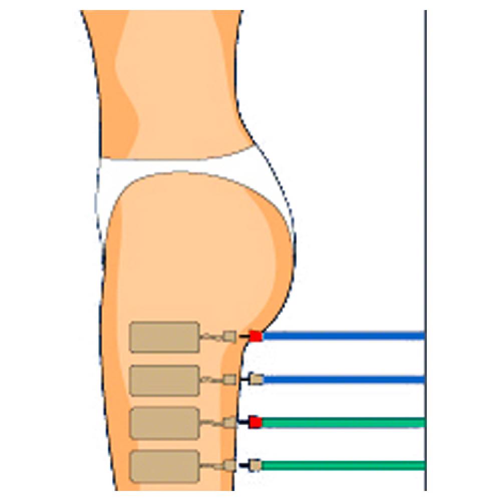 Sport Tec Compex Elektroden Wire, 5x10 cm, 2 Stück Heißer Verkauf