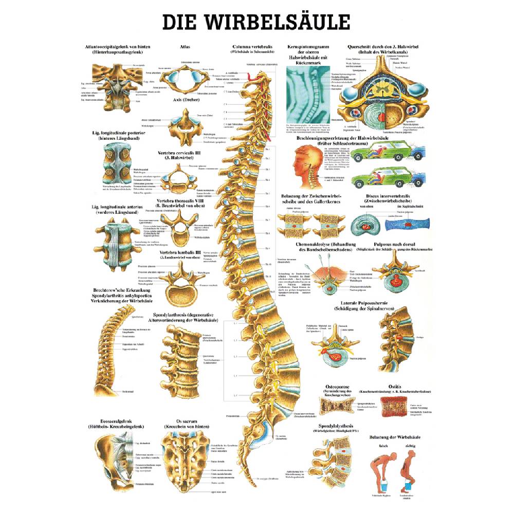 Sport Tec Mini-Poster "Wirbelsäule", LxB 34x24 cm
