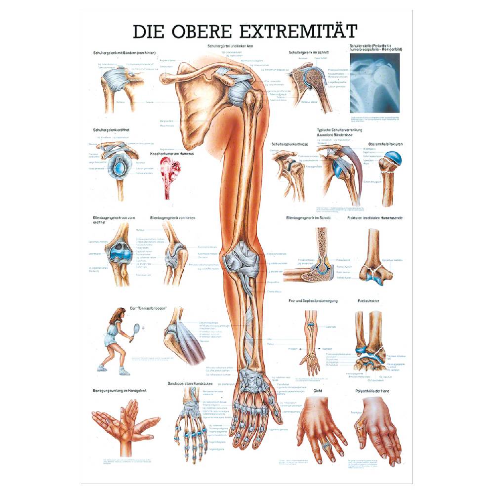 Sport Tec Mini-Poster "Obere Extremität", LxB 34x24 cm