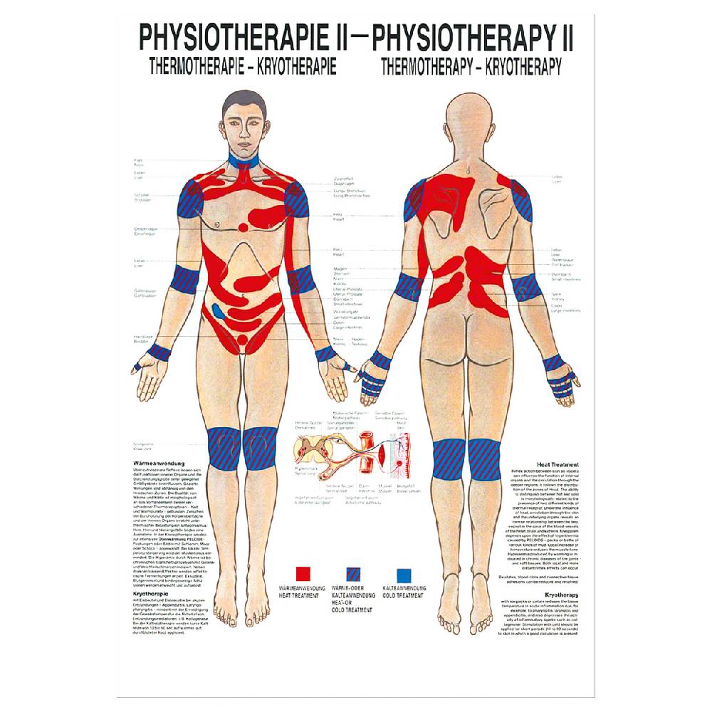 Sport Tec Mini-Poster "Thermotherapie", LxB 34x24 cm Riesige Rabatte