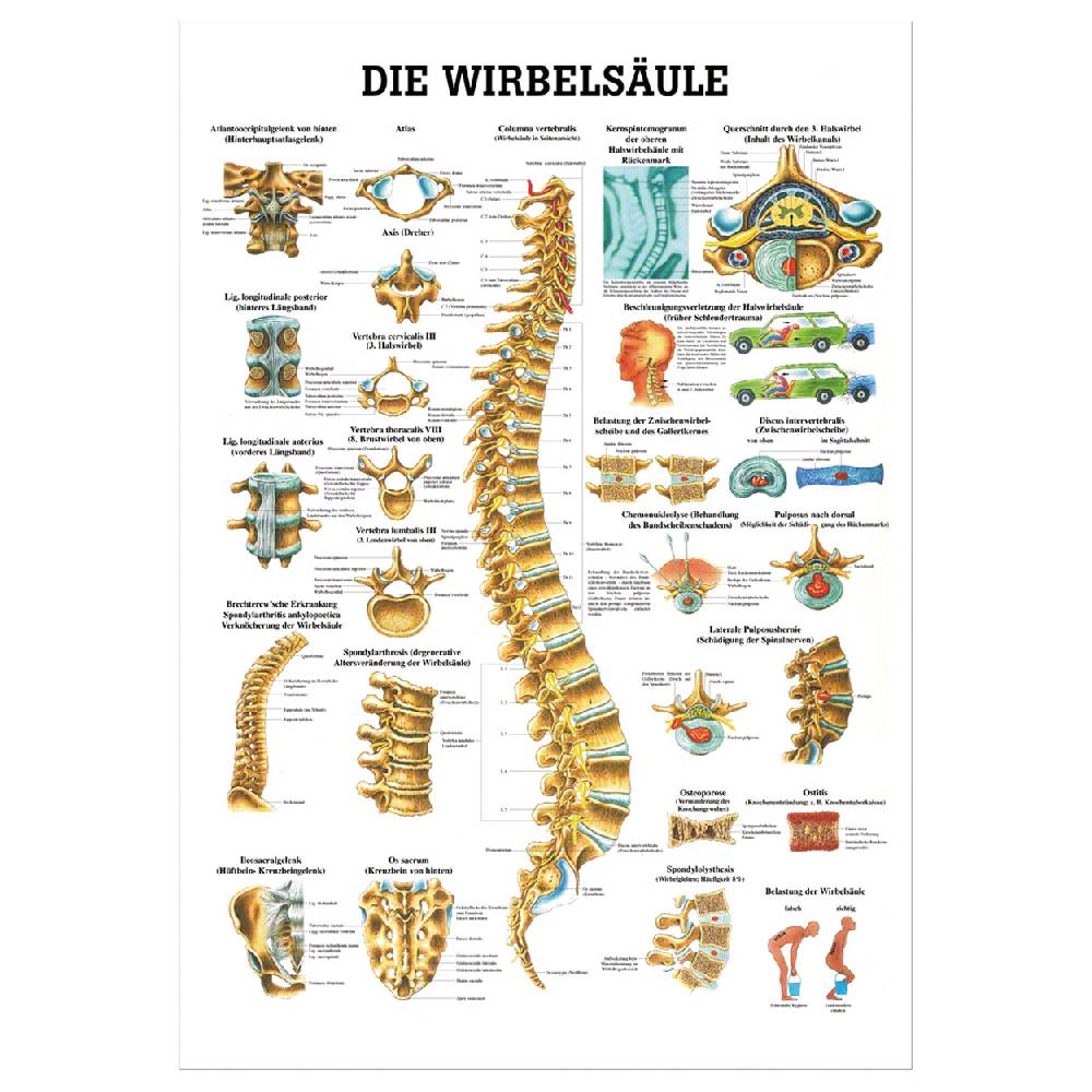 Sport Tec Lehrtafel "Die Wirbelsäule", LxB 100x70 cm
