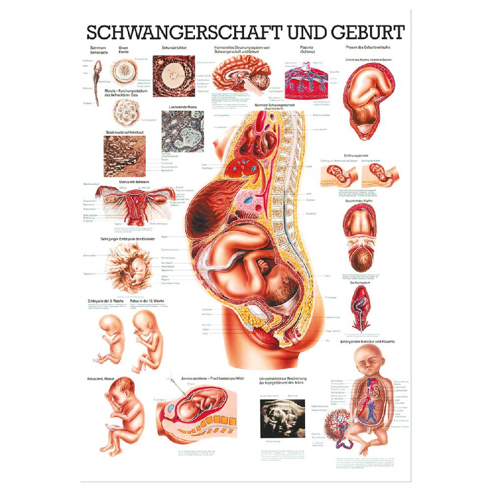 Sport Tec Lehrtafel "Schwangerschaft u. Geburt", LxB 100x70 cm