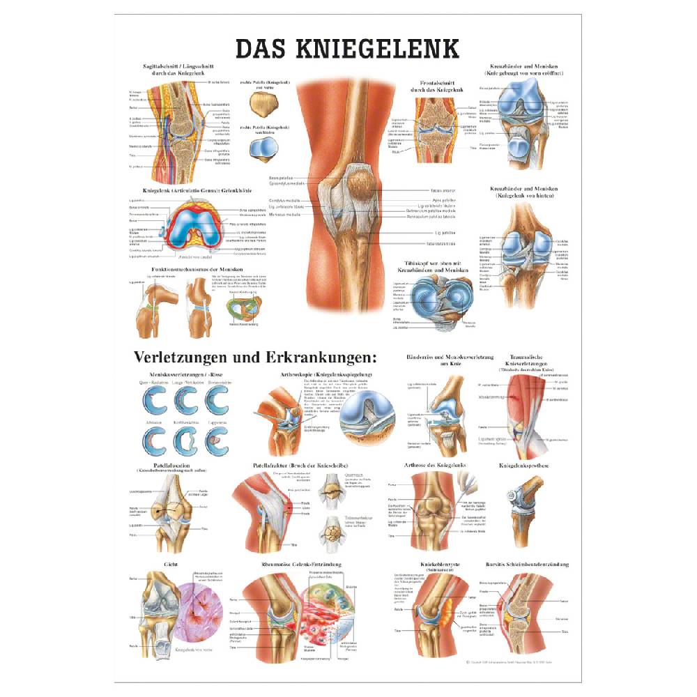 Sport Tec Lehrtafel "Das Kniegelenk", LxB 100x70 cm