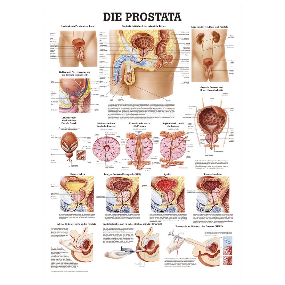 Sport Tec Lehrtafel "Die Prostata" LxB 100x70 cm Online